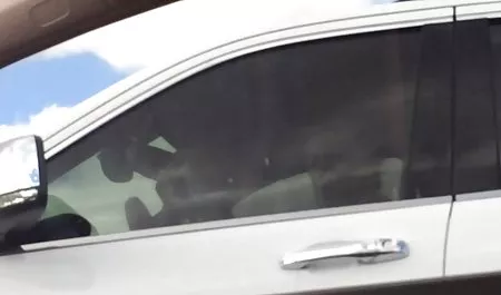 누가 알렉스 시계 prrno 검사